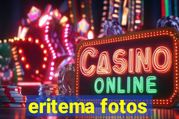 eritema fotos
